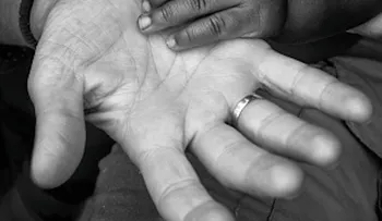 Madre pide ayuda para tratamiento de niño con quemadura cuarto grado 