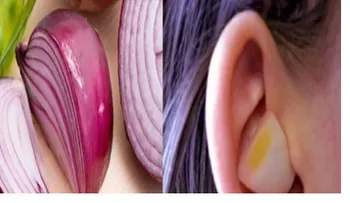 La cebolla no sólo te hace llorar: Te cura de resfriados, tos, friebre, otitis y dolor de oído
