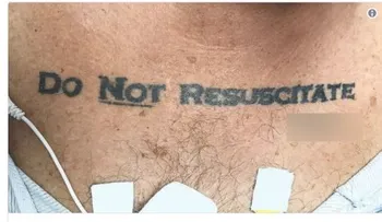 Un hombre llega inconsciente al hospital con un tatuaje escrito: "No resucitar" y deja perplejos a los médicos