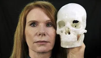Atajo para cirugía del cerebro: hacerlo a través del párpado