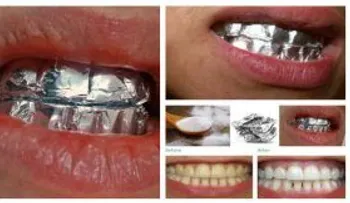 Un sencillo truco con papel aluminio en los dientes por 60 minutos y mira lo que pasa (hombre o mujer)
