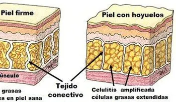 Disminuir la celulitis con esta bebida secreta