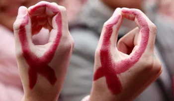 Doctores realizan el primer trasplante de hígado entre pacientes con VIH