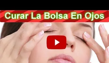Bolsas en los ojos y como curarlas: remedios