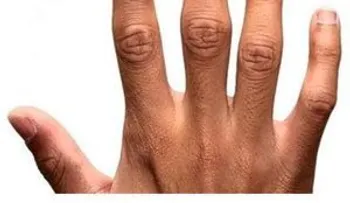 El dedo índice y anular marcaría una tendencia a ser lesbianas; un estudio revela que SÍ, ¿Tú, qué opina?