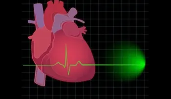 5 actividades que pueden provocar un infarto y no conocías