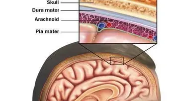 Mueren de meningitis hombres que tuvieron sexo con otros hombres