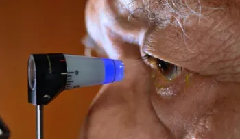  Solo 20 por ciento casos de glaucoma presentan síntomas, alerta especialista 