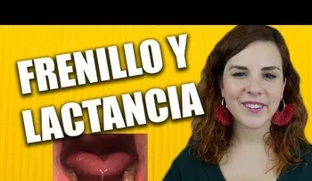 ¿Cómo afecta la LACTANCIA con el FRENILLO corto?
