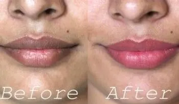 Increíble truco para blanquear labios oscuros naturalmente!