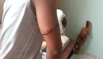 Envían a la cárcel haitiano macheteó hijo de periodista Erick Montilla