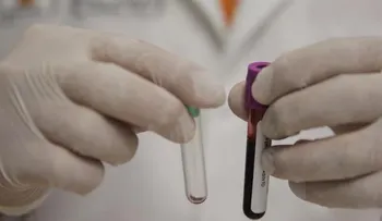 Científicos crean tatuaje biomédico que detecta altos niveles de calcio en sangre 