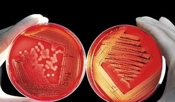 Revuelo científico: trasplantan con éxito en Rusia el primer órgano creado con bioimpresora 3D (VIDEO)