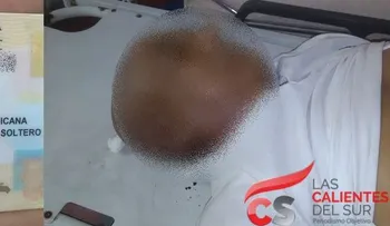 Un hombre que tenía un virus gripal muere tras tomarse unas pastillas de moquillo para gallo 
