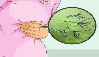 ¡Médico de Japón revela cómo matar bacteria Helicobacter Pylori de RAIZ!!..