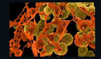 Hallan por primera vez en EE.UU. una superbacteria resistente a los antibióticos