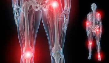 Solución para dolores articulares: Cataplasma de arcilla y cúrcuma 