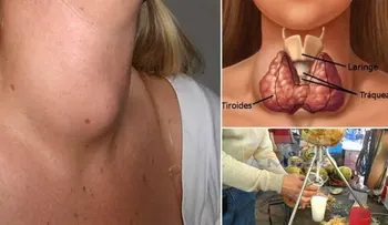 Estas son las toxinas que destruyen tu glándula tiroides y esta bebida saludable puede sanarla