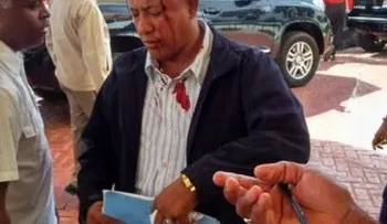 Agreden hombre a trompadas porque molestaba a Federico Antún Batlle