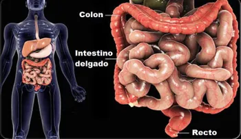 10 signos de que tienes un intestino enfermo