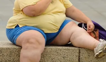 La obesidad afecta al funcionamiento del intestino humano, según un estudio