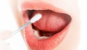  Científicos descubren sustancia en la saliva que ayuda a detectar cáncer oral 