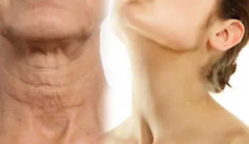 Descubre la manera más sencilla de hacer que tu cuello luzca joven. Es alucinante!