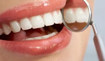 8 formas para reducir visitas al dentista 