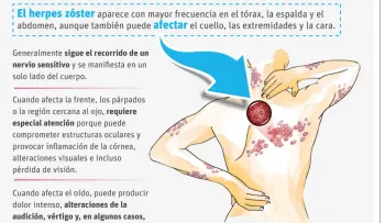 Herpes zóster: el virus que puede reactivarse décadas después y cómo prevenirlo