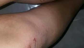 Una mujer se salva de "tablitas" de atracadores