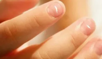 ¿Por qué aparecen las manchas blancas en las uñas? ¡Aquí la razón!