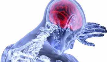 La epilepsia: Una afección común que afecta al cerebro