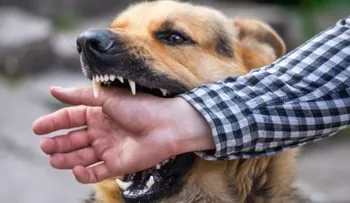 Conoce estas enfermedades pueden transmitir perros a los humanos