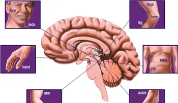 La enfermedad de parkinson; dormir en exceso puede ser un mal sintoma