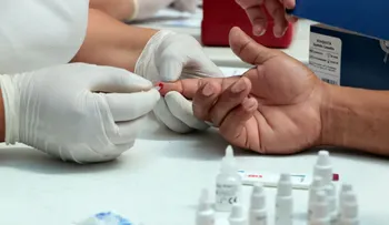 Al menos 95% de quienes viven con VIH se han infectado de papiloma humano