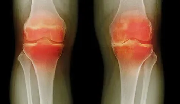 Estiramiento sencillo para tratar el desgaste de rodillas