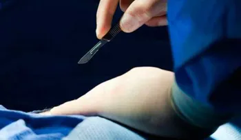 Hospital de Alabama le corta pene a un hombre por error