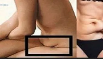 No tenga nunca más el vientre caído; consejos