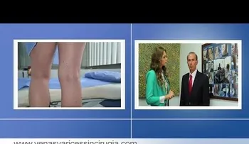 Cómo eliminar ulceras varicosas y venas varices SIN CIRUGIA 