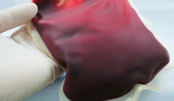 Tribunal ordena transfusión de sangre a recién nacida cuyos padres se oponían por religión