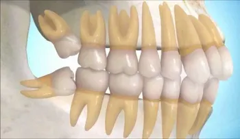 Esta es la estafa dental más grande de todos los tiempos: los odontólogos lo saben pero te dicen otra cosa. 