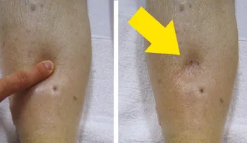 Descubre esta manera para deshacerte de la retención de líquidos en tu cuerpo