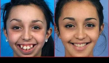 Jovencita luce impresionante tras varias cirugias (VIDEO)