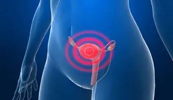 Los 7 factores que influyen en la aparición de un cáncer de útero
