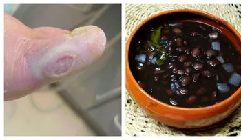 Farmacias han gastado millones de dólares para desaparecer esta receta! Conoce esta milenaria receta para tratar la Diabetes!!