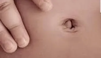 Ponerte aceite en el OMBLIGO? Muy interesante