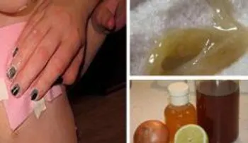 Elimina la tos y flemas de niños y adultos en una sola noche 