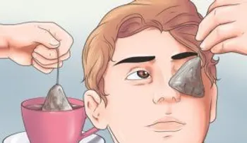 Las ojeras: Cómo eliminarla de manera fácil con este remedio 