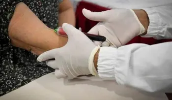 Tener sangre A se asocia a un 50% más de riesgo de sufrir un COVID-19 más severo