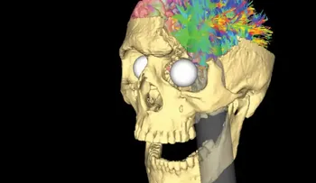 Tres lesiones cerebrales que cambiaron la ciencia de la mente